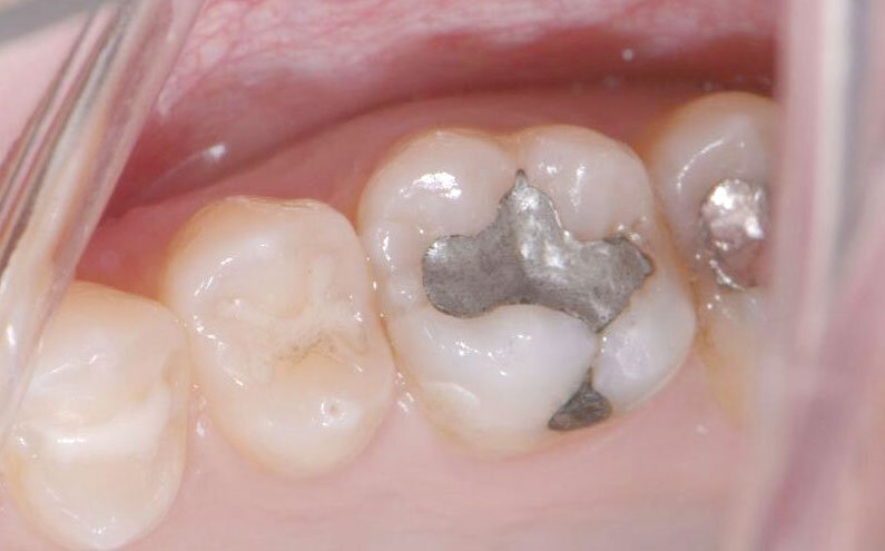 esteticka-stomatologie-01-1