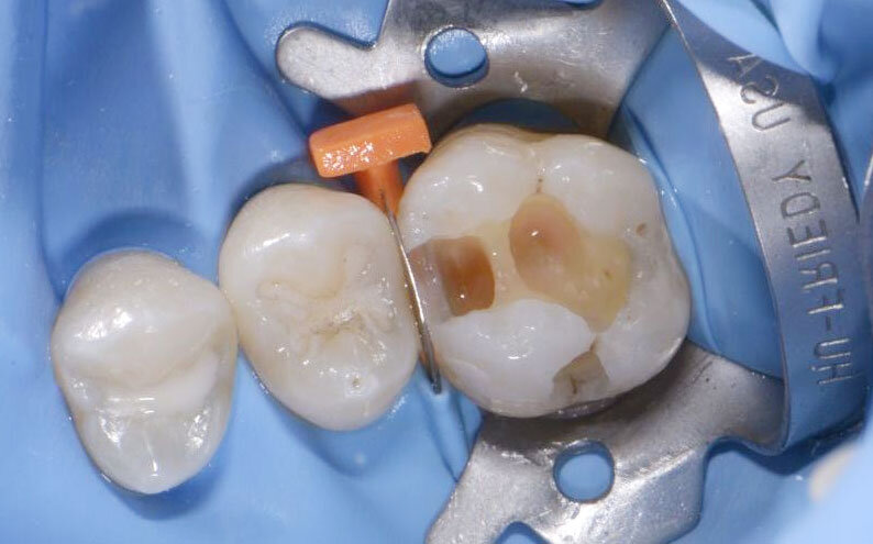 esteticka-stomatologie-02-1