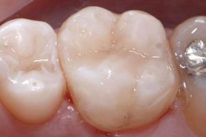 esteticka-stomatologie-04-1-300x200