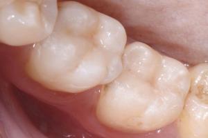 esteticka-stomatologie-07-1-300x200